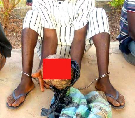 Islamic cleric arrested with human head dies in Police custody